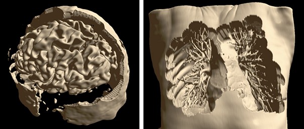 ../_images/mri-clear.jpg