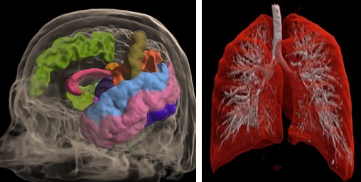 ../_images/mri-roi.jpg