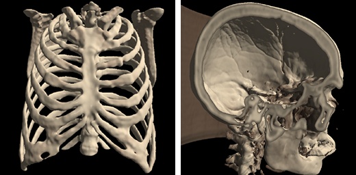 ../_images/mri-surf.jpg